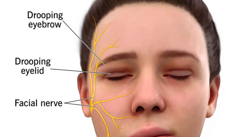 Deciphering Seventh Nerve Disorders: Insights into Etiology, Evaluation, and Management